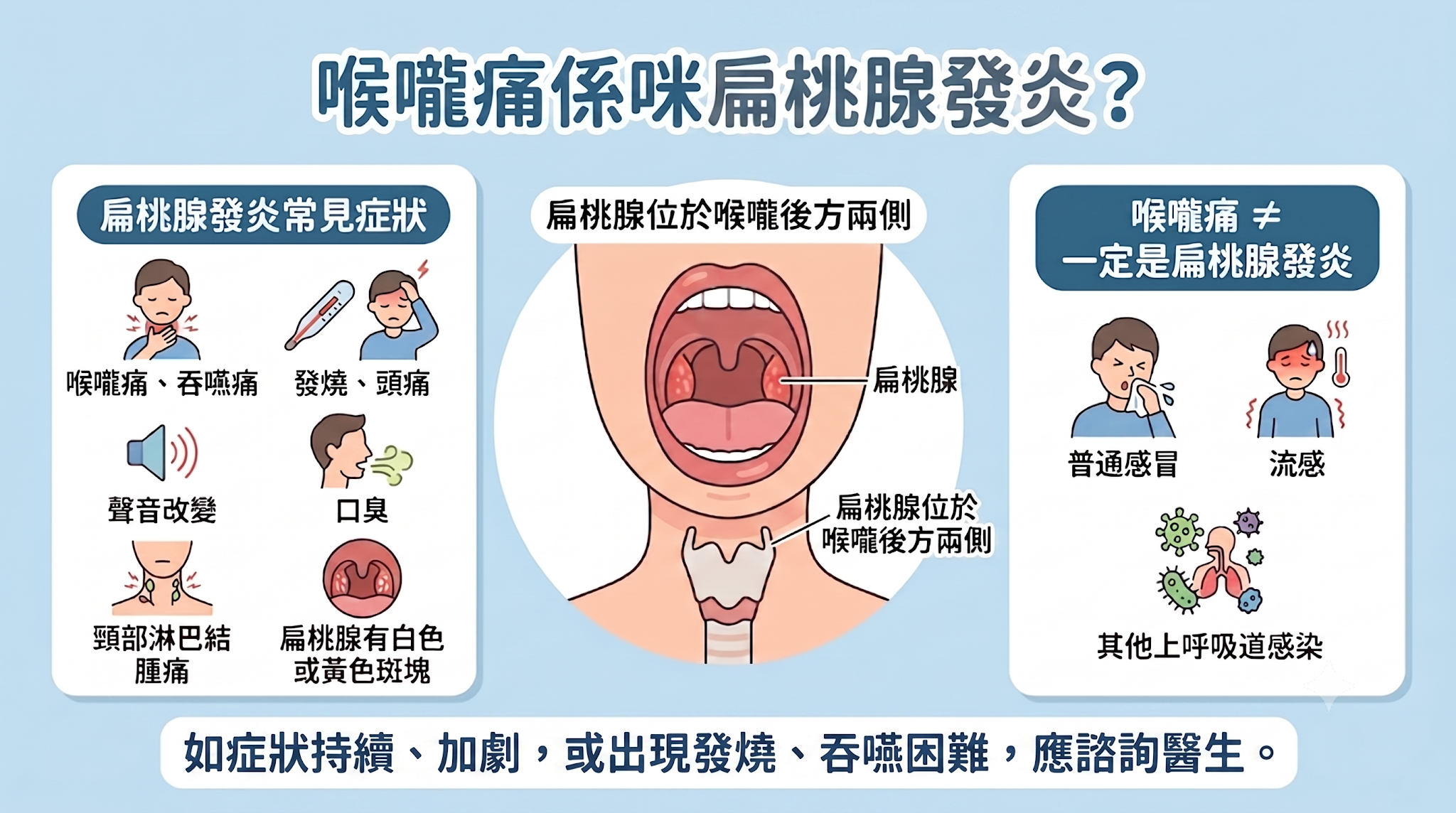 扁桃腺發炎常見症狀及扁桃腺位置圖，顯示喉嚨痛、吞嚥痛、發燒、口臭、頸部淋巴結腫痛及扁桃腺白點等症狀。