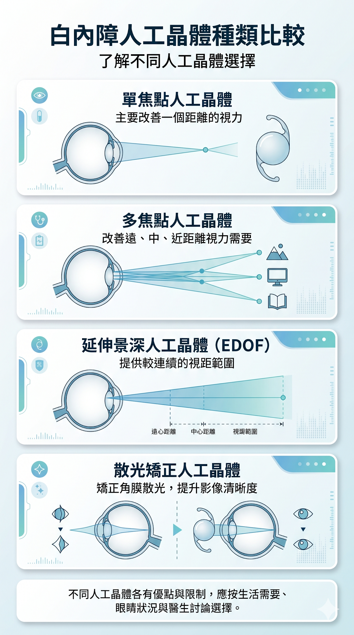 白內障人工晶體種類比較，包括單焦點、多焦點、延伸景深及散光矯正人工晶體的特點